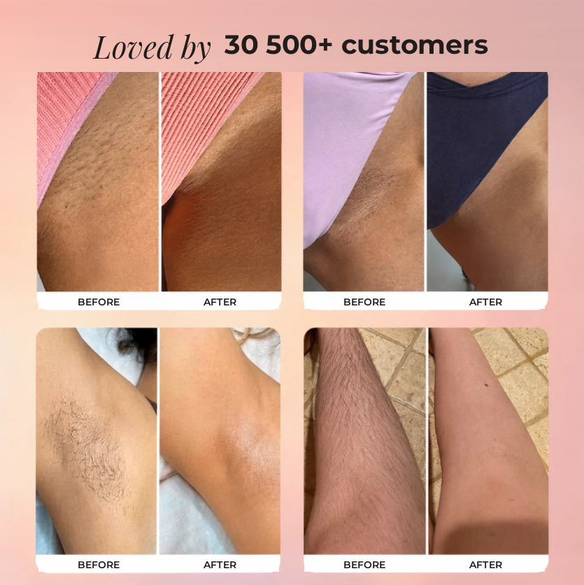 LuYura™ 2.0 – Intimate Grooming Without Irritation